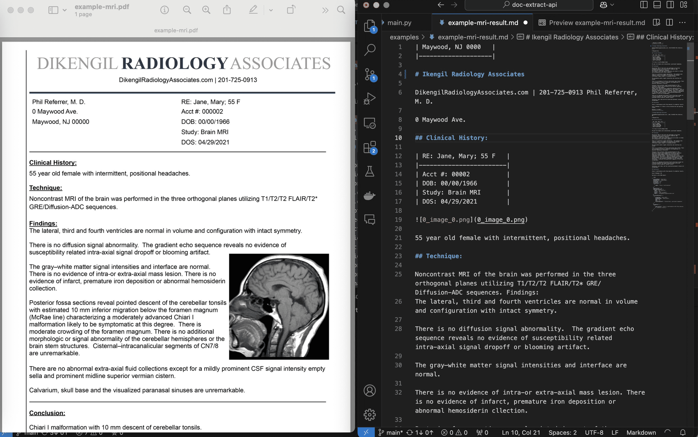 pdf-extract-api:PDF文档或图片转换JSON/Markdown,自动抹去个人信息-1 文本提取API(text-extract-api):视觉提取文本信息,匿名化的PDF提取工具